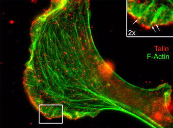 Immunocytochemical labeling of Talin relative to F-actin in chick fibroblasts. The cells were labeled with mouse monoclonal Talin (Rod domain) antibody, then the antibody was detected using appropriate secondary antibody (Red). This labeling is compared to F-actin staining (Green). (Image provided by Dr. Gianluca Gallo at Drexel University).