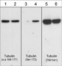 Western blot analysis of purified brain tubulin untreated (lanes 1,3,5) or treated with ERK2 kinase to phosphorylate Ser-172 (lanes 2,4,6). The blot was probed with anti-β-Tubulin (a.a. 168-177) (lanes 1 & 2), anti-β-Tubulin (Ser-172) (lanes 3 & 4), and anti-β-Tubulin (lanes 5 & 6).