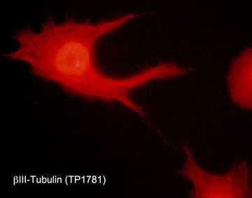 Immunocytochemical labeling of β-tubulin in aldehyde fixed and NP-40 permeabilized human NCI-H1299 lung carcinoma cells. The cells were labeled with rabbit polyclonal anti-β-Tubulin. The antibody was detected using goat anti-rabbit DyLight® 594.