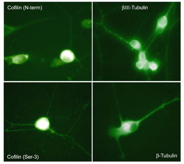 Immunocytochemical labeling in chick dorsal root ganglion neurons using anti-Cofilin (N-terminus), anti-Cofilin (Ser-3), anti-βIII-Tubulin (C-terminus) and anti-β-Tubulin antibodies. (Images provided by Dr. Diane Snow, Department of Anatomy & Neurobiology, University of Kentucky).