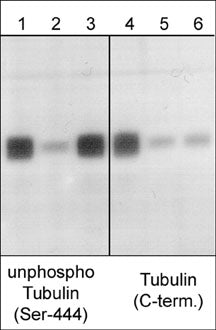 Western blot analysis of mouse brain. The blot was probed with anti-unphosphorylated βIII-Tubulin (Ser-444) (lanes 1-3) and anti-βIII-Tubulin (C-terminus) (lanes 4-6) polyclonal antibodies. Both antibodies were used in the presence of unphosphorylated βIII-Tublin (Ser-444) peptide (lanes 2 & 5) and phospho-βIII-Tublin (Ser-444) peptide (lanes 3 & 6).