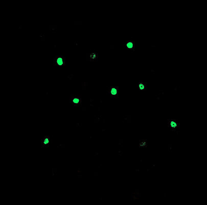 Basolateral amygdala from c-fos-lacZ transgenic male rats labeling LacZ (al, 1:1000, green). The image was kindly provided by Benedetto Sacchetti, Università di Torino.
