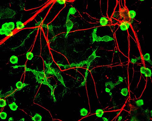 Chicken Anti-Alpha-Internexin (Alpha-Inx)