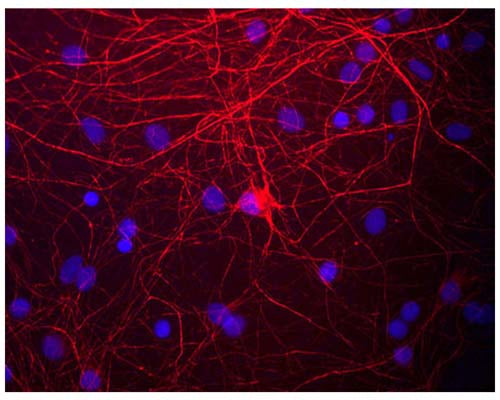 Chicken Anti-Neurofilament Medium Polypeptide (NF-M)