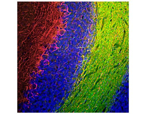 Chicken Anti-Neurofilament Medium Polypeptide (NF-M)