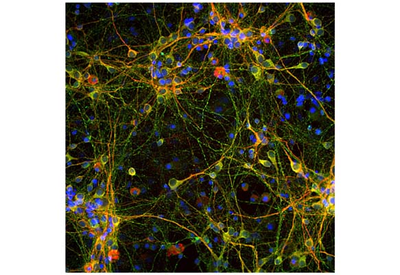 Chicken Anti-Microtubule-Associated Protein Tau (MAPT)