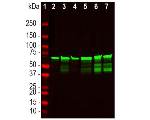 Chicken Anti-Neurofilament Light Polypeptide (NF-L), DG-Sensor