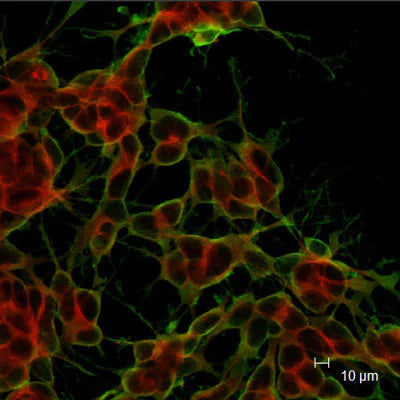 Doublecortin (1:1000 dilution, green) staining of neuroblastoma cells in culture. Red staining is a Golgi apparatus marker. Page Balisch (University of Arizona).