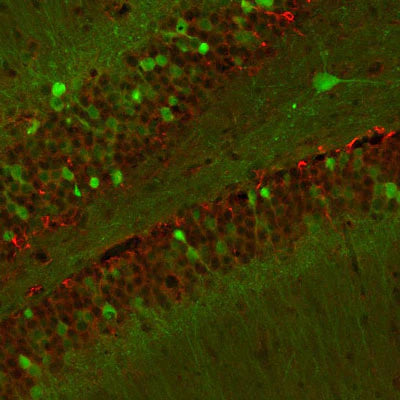Doublecortin (1:1000 dilution, green) staining of a tissue section (4% paraformaldehyde-fixed, paraffin- embedded) through the cerebellar cortex of a neonatal mouse. Red staining is neurofilament, NF- M, visualized with Texas Red-goat anti-rabbit IgG.