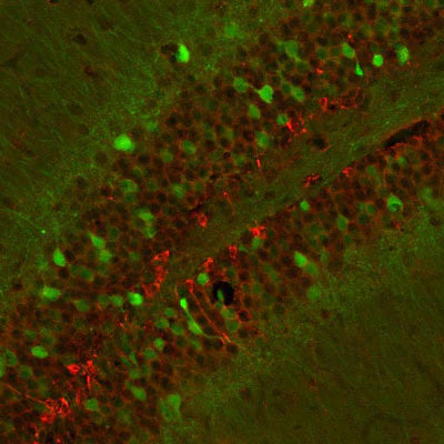 Doublecortin (1:1000 dilution, green) staining of a tissue section (4% paraformaldehyde-fixed, paraffin- embedded) through the cerebellar cortex of a neonatal mouse. Red staining is neurofilament, NF- M, visualized with Texas Red-goat anti-rabbit IgG.