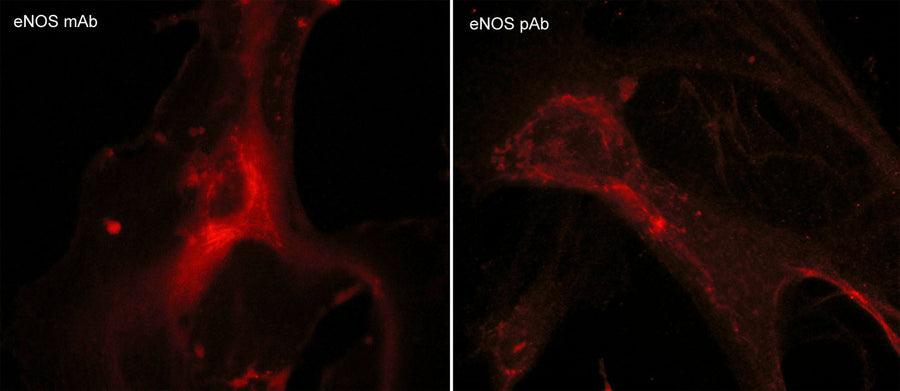 Immunocytochemical labeling of endothelial nitric oxide synthase (eNOS) in paraformaldehyde-fixed and NP-40-permeabilized human umbilical vein endothelial cells. The cells were labeled with mouse monoclonal eNOS and rabbit polyclonal eNOS antibodies, then the antibodies were detected using appropriate secondary antibodies conjugated to Cy3.