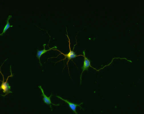 Immunocytochemical staining of GAD-67 (red/yellow) in cultured cortical neurons from a neonatal mouse (C57/Black6). GAD staining was detected using Texas Red goat anti-chicken IgY (1:500). MAP2 staining (green) used a rabbit antibody (1:500).