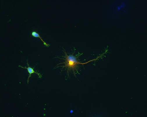Immunocytochemical staining of GAD-67 (red/yellow) in cultured cortical neurons from a neonatal mouse (C57/Black6). GAD staining was detected using Texas Red goat anti-chicken IgY (1:500). MAP2 staining (green) used a rabbit antibody (1:500).