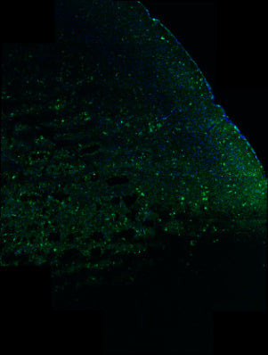 Immunostaining of 5xFAD mouse brain section fixed in 4% paraformaldehyde and preserved in cryoprotectant showing specific detection of IBA1 positive cells (1:100; green) in the cortex. Nuclei stained with DAPI (blue). Background stain was attenuated with TrueVIEW. Image kindly provided by Ifeoluwa (Hiphy) Awogbindin of the Tremblay Lab, Division of Medical Sciences, University of Victoria, Canada.