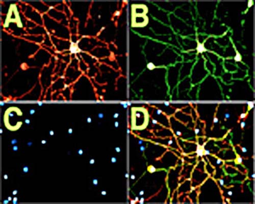 Mouse Anti-NGFR/p75 Neurotrophin Receptor (p75NTR)