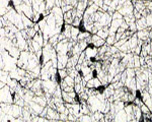 Mouse Anti-NGFR/p75 Neurotrophin Receptor (p75NTR)