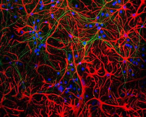 Mouse Anti-Glial Fibrillary Acidic Protein (GFAP) (Clone 3E10)