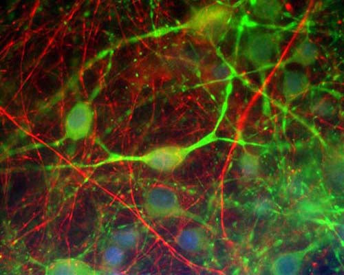 Mouse Anti-Internexin Alpha (Alpha-Inx)
