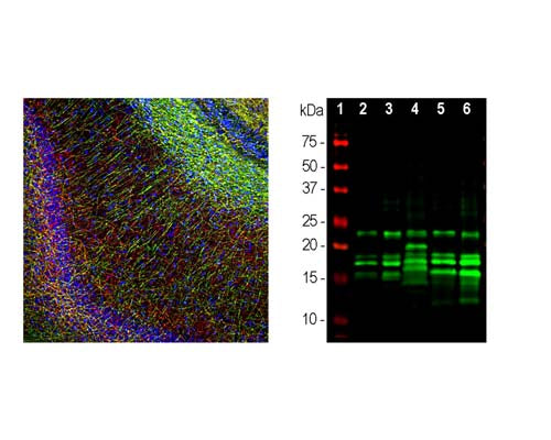 Mouse Anti-Myelin Basic Protein (MBP) (Clone 7D2)