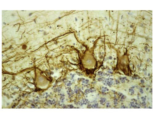 Mouse Anti-Neurofilament Heavy Polypeptide, Phosphorylated, (pNF-H, NAP4)