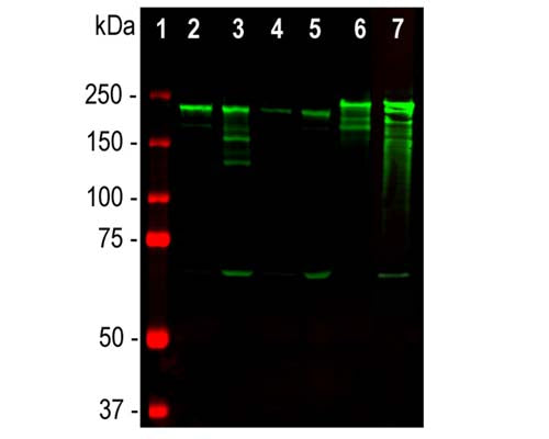 Mouse Anti-Neurofilament Heavy Polypeptide, Phosphorylated, (pNF-H, NAP4)