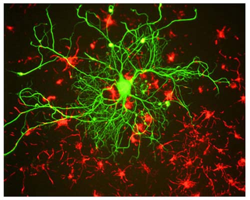 Mouse Anti-Neurofilament Light Polypeptide (NF-L, DA2)