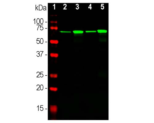 Mouse Anti-Neurofilament Light Polypeptide (NF-L, DA2)