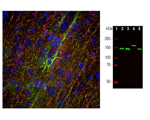 Mouse Anti-Neurofilament Medium Polypeptide (NF-M, 3H11)