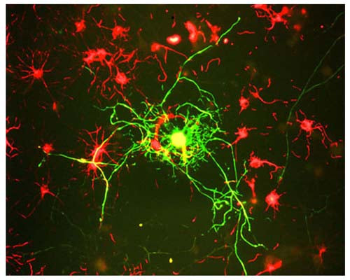 Mouse Anti-Neurofilament Medium Polypeptide (NF-M, 3H11)