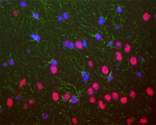 Mouse Anti-TAR DNA-Binding Protein 43 (TDP-43)