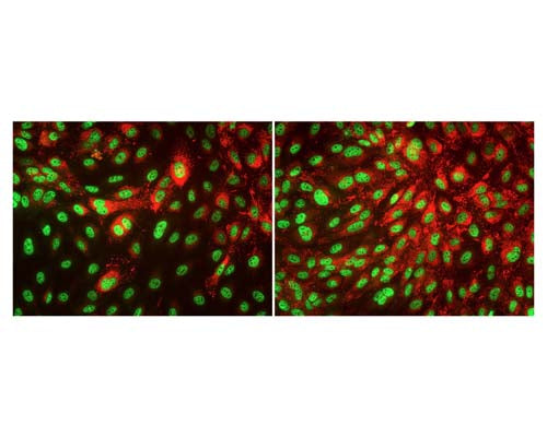 Mouse Anti-TAR DNA-Binding Protein 43 (TDP-43)