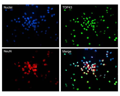 Mouse Anti-TAR DNA-Binding Protein 43 (TDP-43)