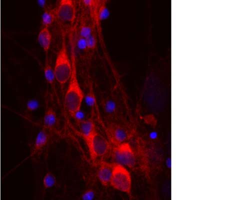 Mouse Anti-14-3-3 Protein Eta