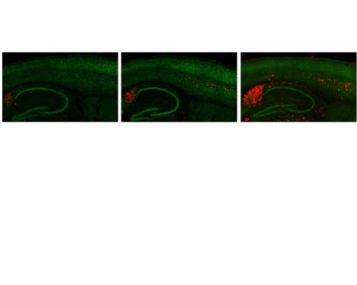 Mouse Anti-Amyloid Beta Peptide (A-beta 40/42)