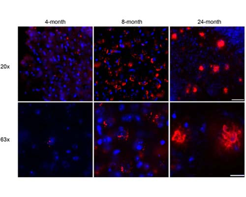Mouse Anti-Amyloid Beta Peptide (A-beta 40/42)