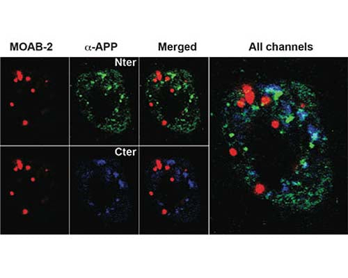 Mouse Anti-Amyloid Beta Peptide (A-beta 40/42)