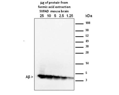 Mouse Anti-Amyloid Beta Peptide (A-beta 40/42)