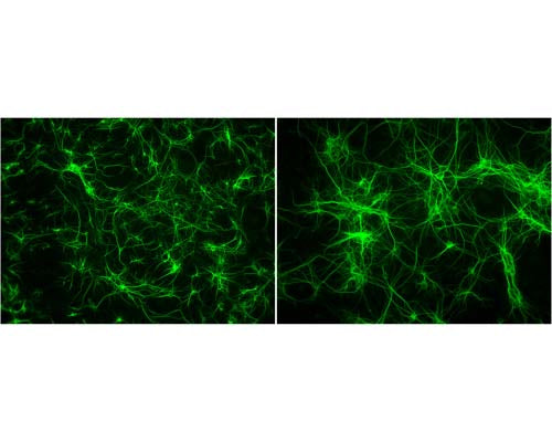 Mouse Anti-Microtubule Associated Protein 2 (MAP2)