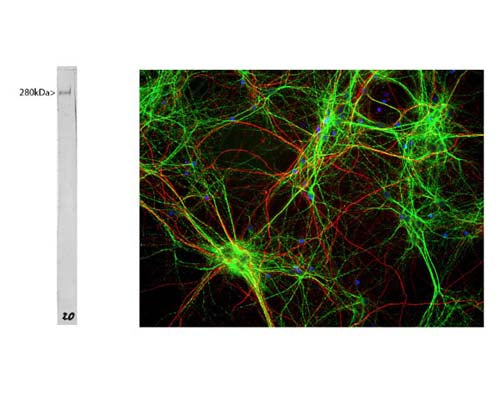 Mouse Anti-Microtubule Associated Protein 2 (MAP2)
