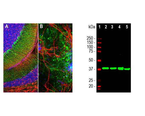 Mouse Anti-Aldolase C