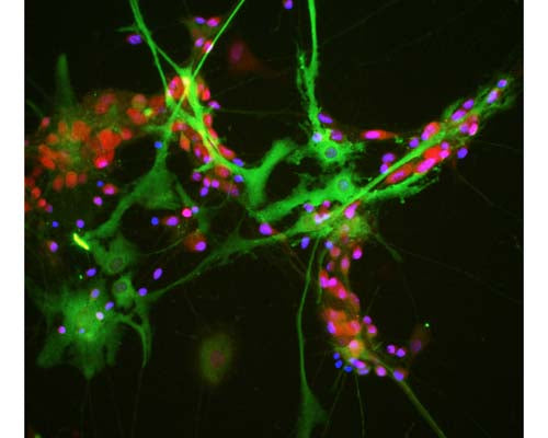 Mouse Anti-Aldolase C