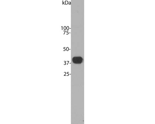 Mouse Anti-Aldolase C