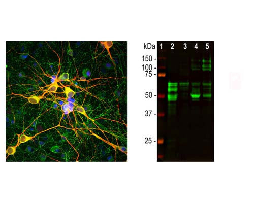 Mouse Anti-Microtubule-Associated Protein Tau (MAPT)