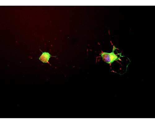 Mouse Anti-Microtubule-Associated Protein Tau (MAPT)