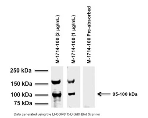 Mouse Anti-Capsaicin Receptor (VR1/TrpV1)