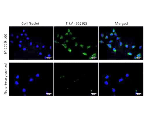 Mouse Anti-Tyrosine Kinase Receptor A (TrkA)