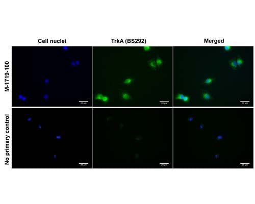 Mouse Anti-Tyrosine Kinase Receptor A (TrkA)
