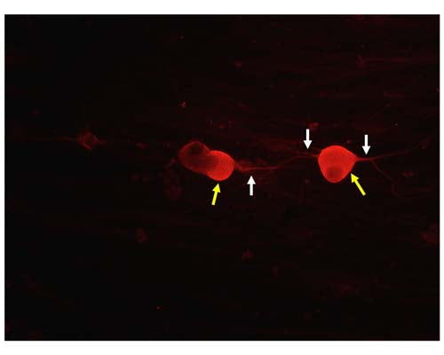 Mouse Anti-Tyrosine Kinase Receptor A (TrkA)