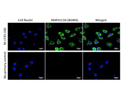 Mouse Anti-Microtubule-Associated Proteins 1A/1B Light Chain 3A (MAP1LC3A)