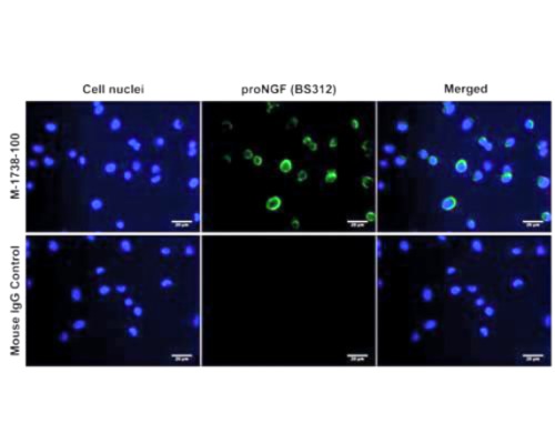 Mouse Anti-Pro-Nerve Growth Factor (proNGF)